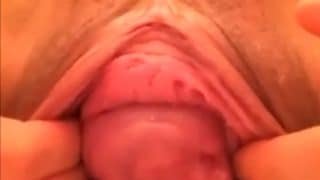  This Is Another Pure Amateur Content Of A Young And Sexy Girl With Double Prolapse
